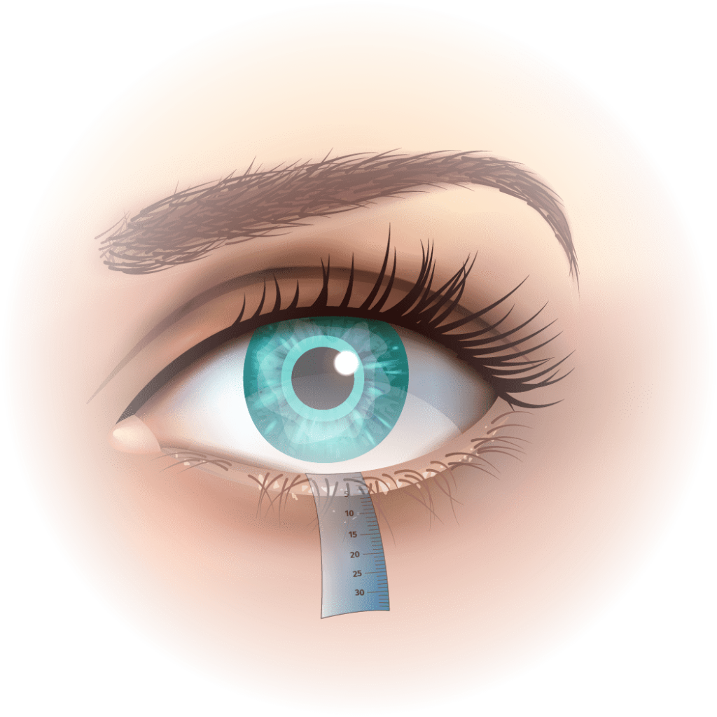 Schirmer’s test diagnosis