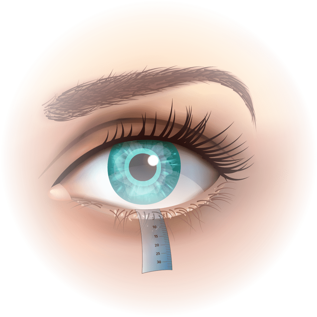 Diagnosis 3 test schirmer secheresse oculaire